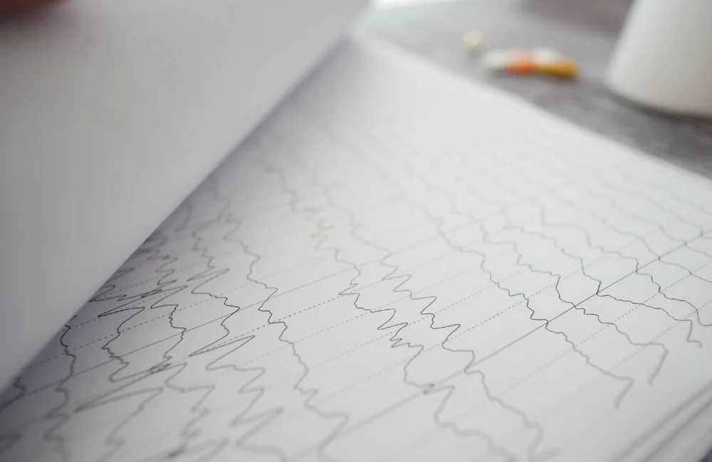 ตรวจคลื่นไฟฟ้าสมอง